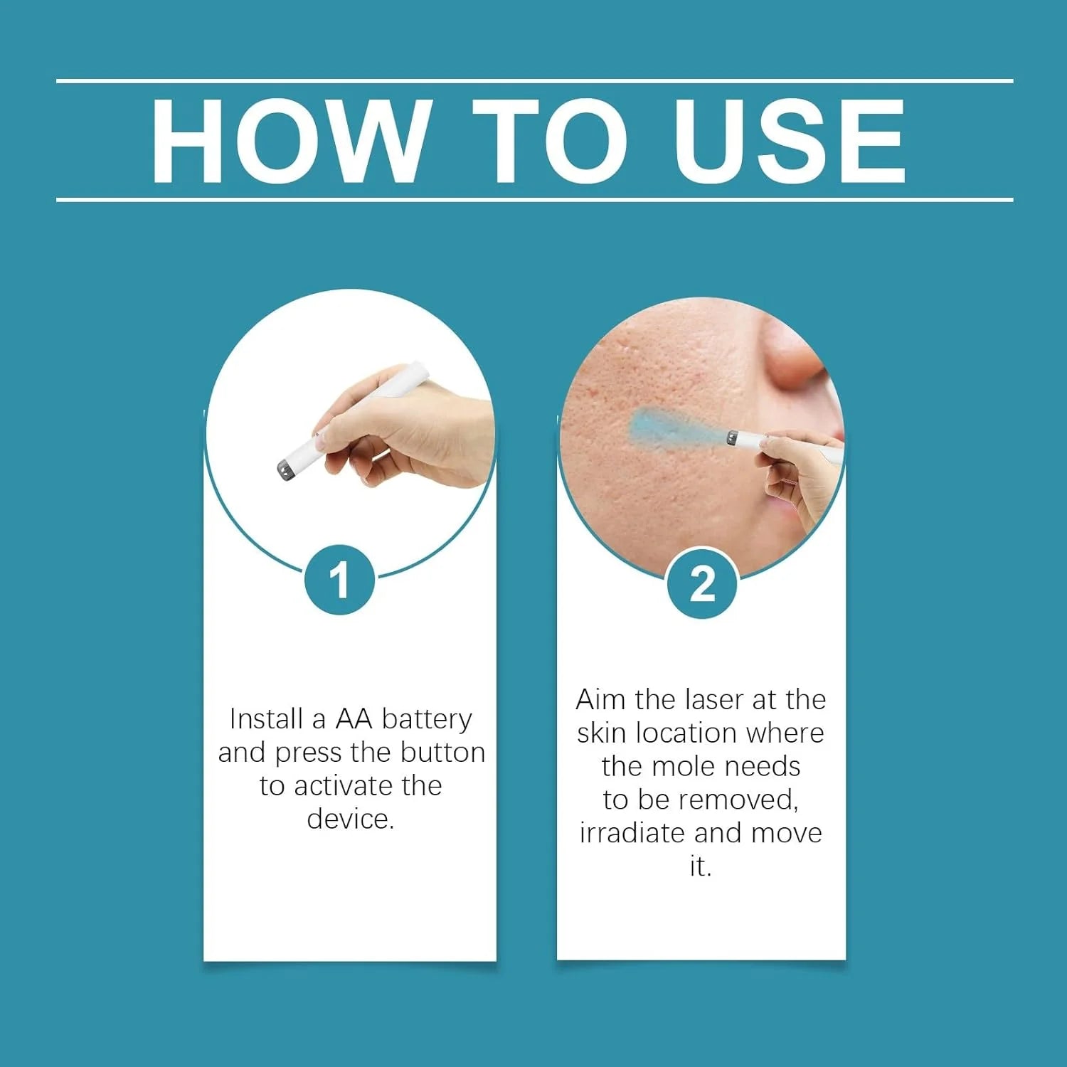 Xorita Non-Invasive Mole and Wart Removal Pen